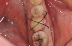 86B17391-7531-4BBD-A873-D869B3712271