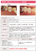 セレックインレー