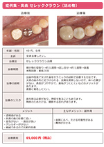 セレッククラウン