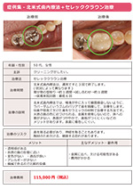 セレッククラウン