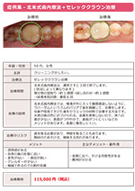 セレッククラウン