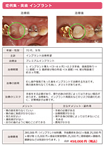 プレミアムインプラント