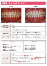 ホワイトニング