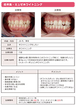 ホワイトニング