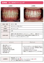 ホワイトニング