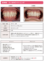 ホワイトニング