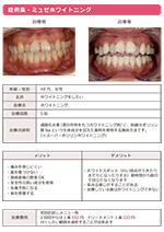 ホワイトニング