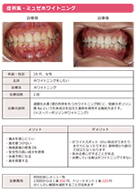ホワイトニング
