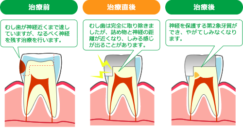 ムシ歯のはじまりとだ液の働き。